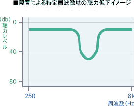 グラフ